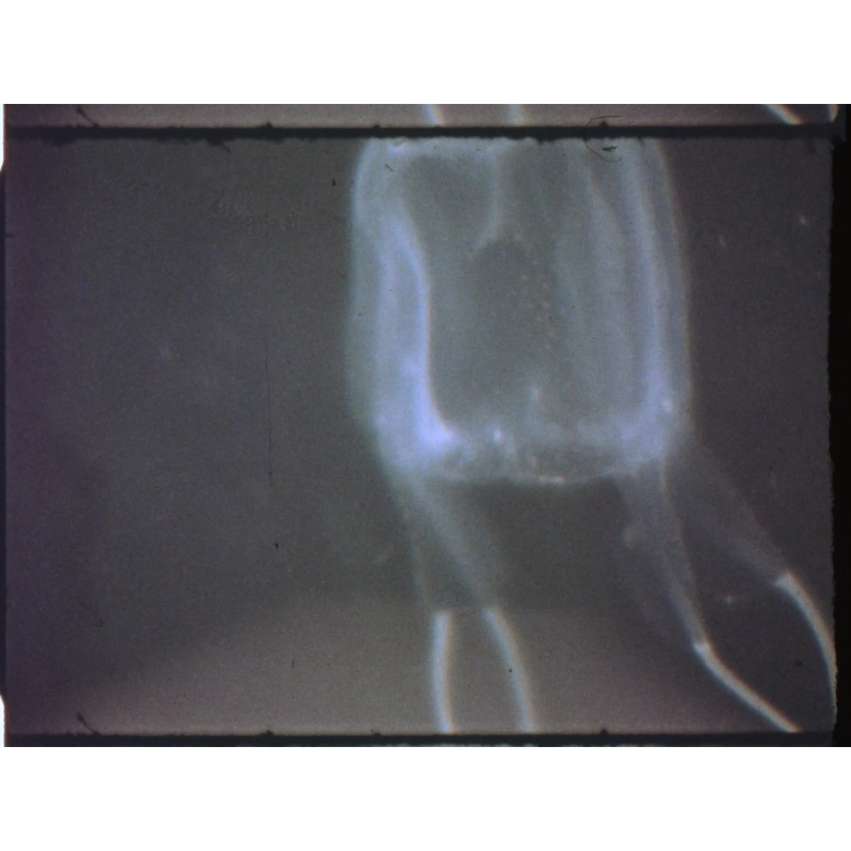 Box jellyfish